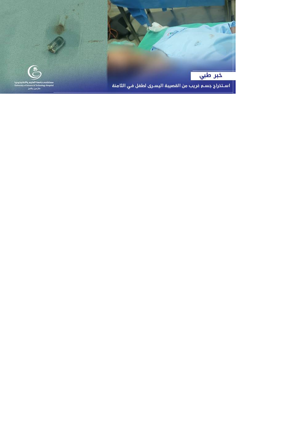 تسببت بانسداد جزئي في رئة طفل في الثامنة